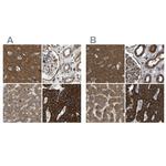 C1GALT1 Antibody in Immunohistochemistry (IHC)