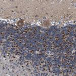 ZP2 Polyclonal Antibody