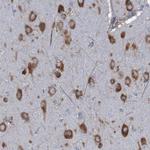 RPL10 Polyclonal Antibody