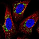 TMEM246 Polyclonal Antibody