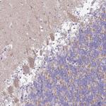 TMEM246 Antibody in Immunohistochemistry (Paraffin) (IHC (P))