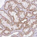 TMEM246 Antibody in Immunohistochemistry (Paraffin) (IHC (P))