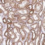 ZNF211 Polyclonal Antibody