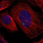 GCM1 Polyclonal Antibody