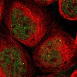 SAP18 Polyclonal Antibody