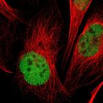 PCGF1 Polyclonal Antibody