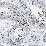PCGF1 Antibody in Immunohistochemistry (IHC)