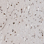 Cdc5L Antibody in Immunohistochemistry (Paraffin) (IHC (P))