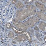 SGK2 Antibody in Immunohistochemistry (Paraffin) (IHC (P))