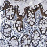 SGK2 Antibody in Immunohistochemistry (Paraffin) (IHC (P))