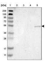 SGK2 Antibody in Western Blot (WB)