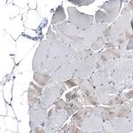 MS4A6A Antibody in Immunohistochemistry (Paraffin) (IHC (P))