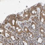 SDK1 Antibody in Immunohistochemistry (Paraffin) (IHC (P))