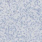 B4GALNT3 Antibody in Immunohistochemistry (IHC)