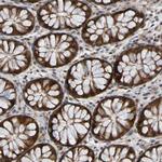 CCDC51 Antibody in Immunohistochemistry (Paraffin) (IHC (P))