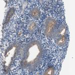 PEX2 Antibody in Immunohistochemistry (Paraffin) (IHC (P))