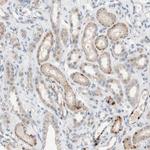PEX2 Antibody in Immunohistochemistry (Paraffin) (IHC (P))
