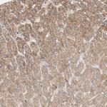 PEX2 Antibody in Immunohistochemistry (Paraffin) (IHC (P))