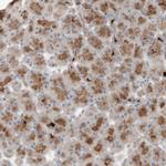 PEX2 Polyclonal Antibody