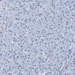 SGCB Antibody in Immunohistochemistry (Paraffin) (IHC (P))
