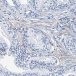 SGCB Antibody in Immunohistochemistry (Paraffin) (IHC (P))