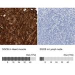 SGCB Antibody in Immunohistochemistry (IHC)