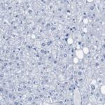 ERVMER34-1 Antibody in Immunohistochemistry (Paraffin) (IHC (P))