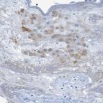 ERVMER34-1 Antibody in Immunohistochemistry (Paraffin) (IHC (P))