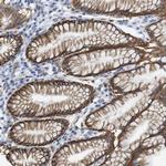 ERVMER34-1 Antibody in Immunohistochemistry (Paraffin) (IHC (P))