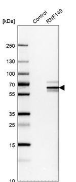 RNF149 Antibody in Western Blot (WB)