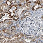 MTX1 Antibody in Immunohistochemistry (Paraffin) (IHC (P))