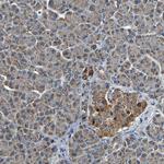 MTX1 Antibody in Immunohistochemistry (Paraffin) (IHC (P))