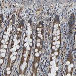 MTX1 Antibody in Immunohistochemistry (Paraffin) (IHC (P))