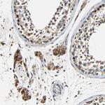 MTX1 Antibody in Immunohistochemistry (Paraffin) (IHC (P))