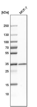 MTX1 Antibody in Western Blot (WB)