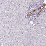 SIRPB2 Polyclonal Antibody