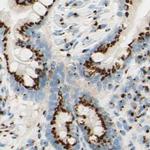 GOLGB1 Antibody in Immunohistochemistry (IHC)
