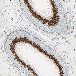 GOLGB1 Antibody in Immunohistochemistry (IHC)