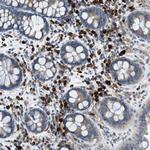 HEG1 Antibody in Immunohistochemistry (Paraffin) (IHC (P))
