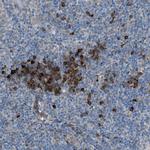HEG1 Antibody in Immunohistochemistry (Paraffin) (IHC (P))