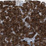 HEG1 Antibody in Immunohistochemistry (Paraffin) (IHC (P))