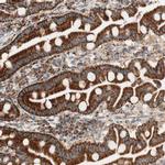 TOMM20 Antibody in Immunohistochemistry (IHC)
