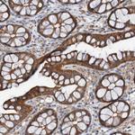 ST8SIA6 Antibody in Immunohistochemistry (Paraffin) (IHC (P))
