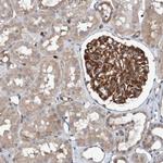 ST8SIA6 Antibody in Immunohistochemistry (Paraffin) (IHC (P))