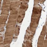 ST8SIA6 Antibody in Immunohistochemistry (Paraffin) (IHC (P))