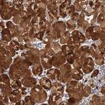 ST8SIA6 Antibody in Immunohistochemistry (Paraffin) (IHC (P))