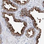 FIBP Antibody in Immunohistochemistry (Paraffin) (IHC (P))