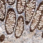SELENBP1 Antibody in Immunohistochemistry (Paraffin) (IHC (P))