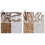 SELENBP1 Antibody in Immunohistochemistry (IHC)