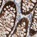 SELENBP1 Antibody in Immunohistochemistry (IHC)